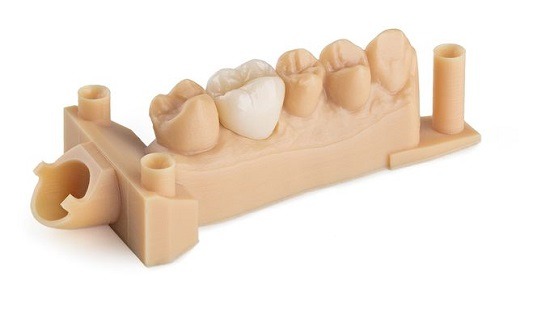 Mô hình răng in 3D