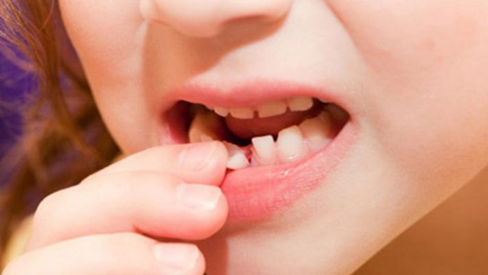 Răng sữa có thể giúp cứu mạng trẻ