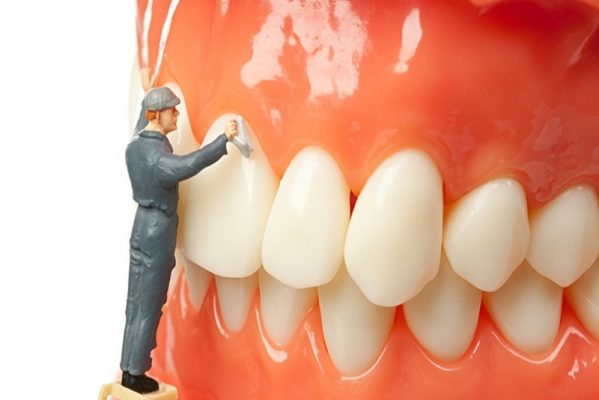 cạo vôi răng và những rủi ro cho sức khỏe răng miệng